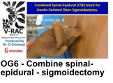 OG6 - Combine spinal-epidural - sigmoidectomy