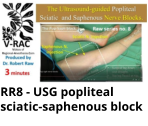 RR8 - USG popliteal sciatic-saphenous block