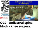 OG9 - Unilateral spinal block - knee surgery.