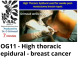 OG11 - High thoracic epidural - breast cancer