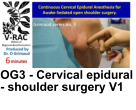 OG3 - Cervical epidural - shoulder surgery V1