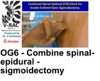 OG6 - Combine spinal-epidural - sigmoidectomy