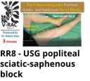 RR8 - USG popliteal sciatic-saphenous block