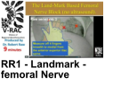 RR1 - Landmark - femoral Nerve