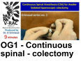 OG1 - Continuous spinal - colectomy