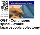 OG7 - Continuous spinal - awake laparoscopic colectomy