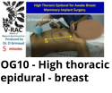 OG10 - High thoracic epidural - breast