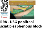 RR8 - USG popliteal sciatic-saphenous block
