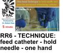 RR6 - TECHNIQUE: feed catheter - hold needle - one hand