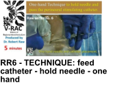 RR6 - TECHNIQUE: feed catheter - hold needle - one hand