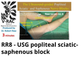RR8 - USG popliteal sciatic-saphenous block