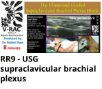RR9 - USG supraclavicular brachial plexus