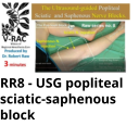 RR8 - USG popliteal sciatic-saphenous block