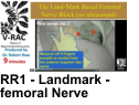 RR1 - Landmark - femoral Nerve