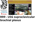 RR9 - USG supraclavicular brachial plexus