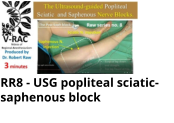 RR8 - USG popliteal sciatic-saphenous block