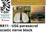 RR11 - USG parasacral sciatic nerve block