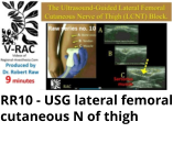 RR10 - USG lateral femoral cutaneous N of thigh