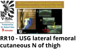 RR10 - USG lateral femoral cutaneous N of thigh