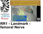 RR1 - Landmark - femoral Nerve
